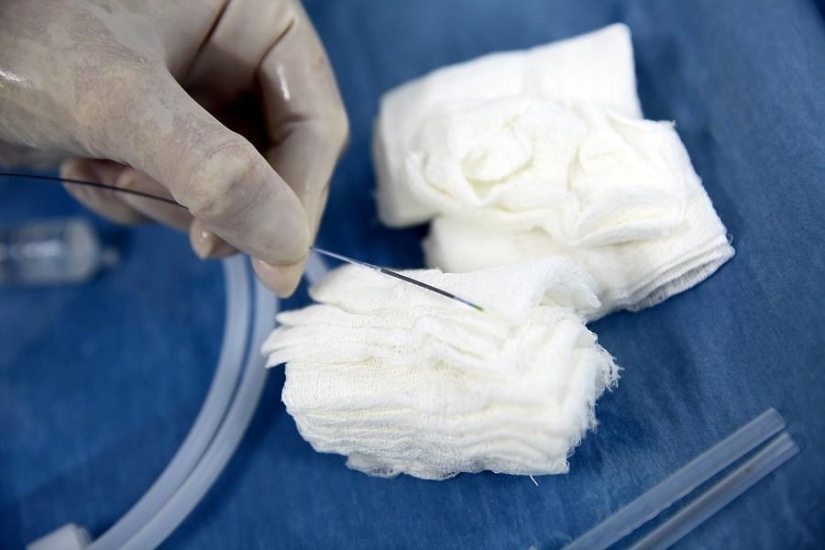 Matters of the Heart, or Operation Without Cuts Matters of the Heart, or Operation Without Cuts