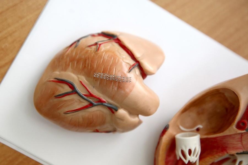 Matters of the Heart, or Operation Without Cuts Matters of the Heart, or Operation Without Cuts