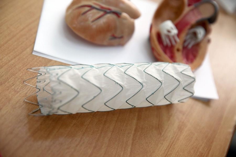 Matters of the Heart, or Operation Without Cuts Matters of the Heart, or Operation Without Cuts