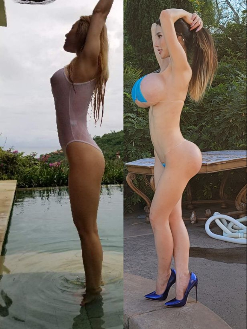 Model from China went too far with implants in the buttocks and now can not sit Model from China went too far with implants in the buttocks and now can not sit