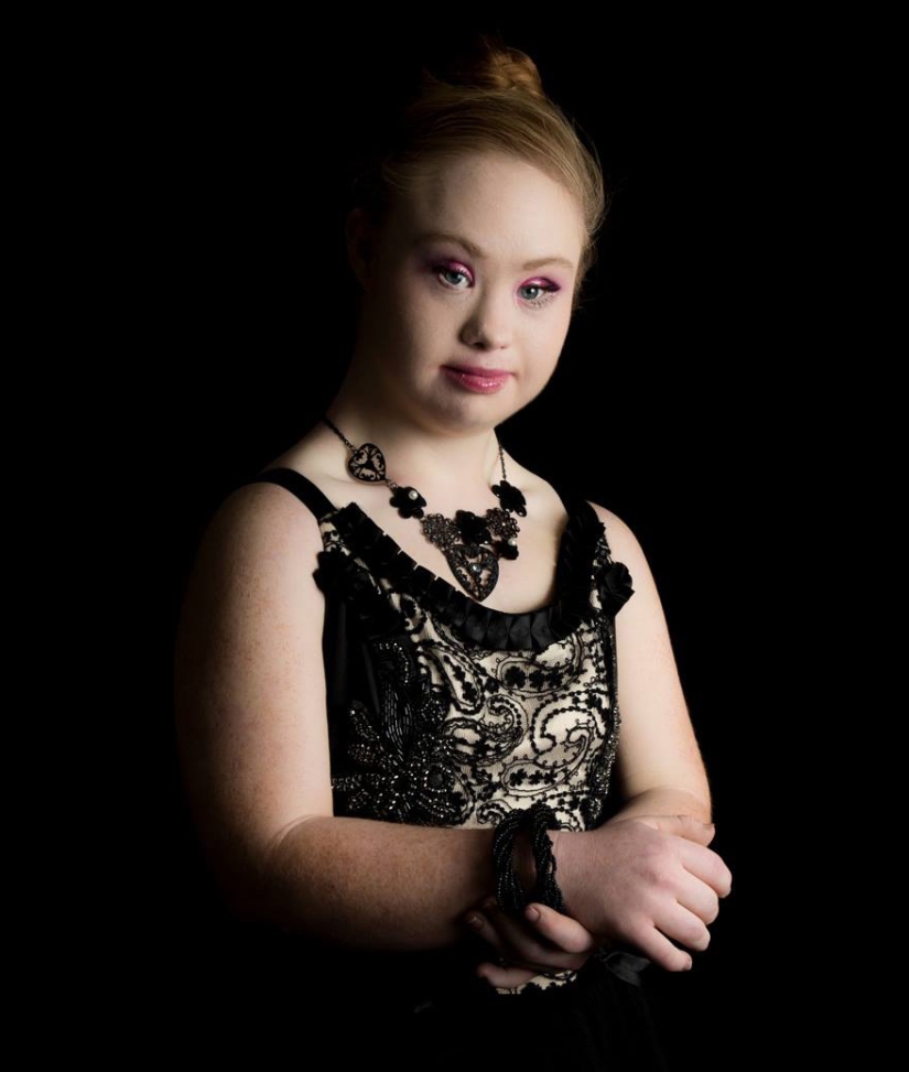 Model with Down syndrome: "We can be beautiful and sexy"