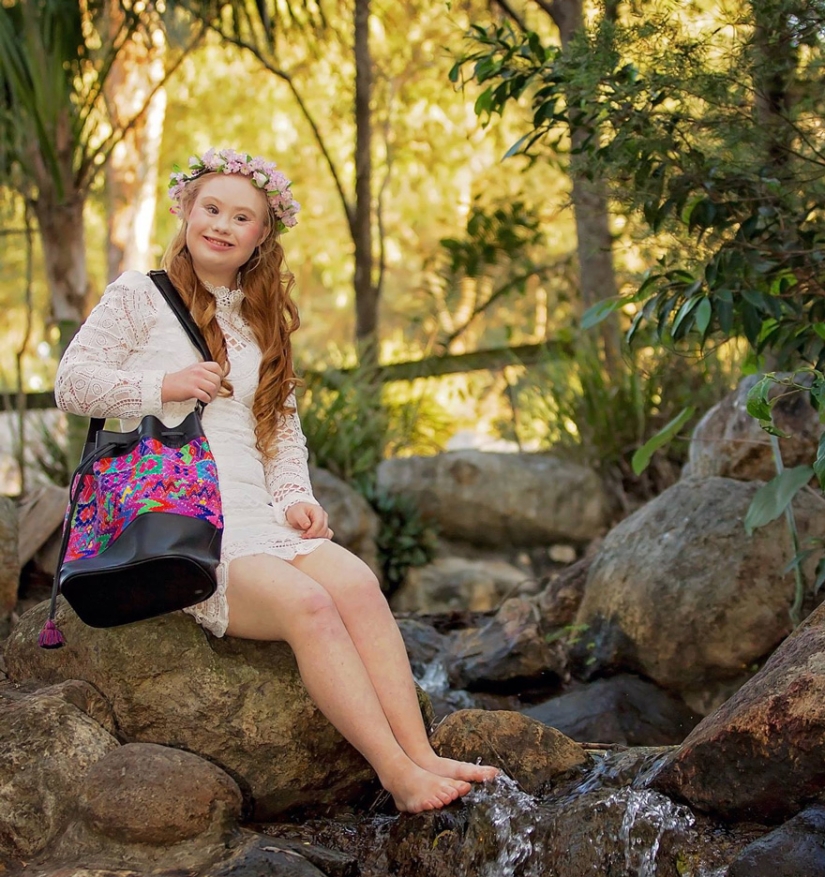 Model with Down syndrome: "We can be beautiful and sexy"