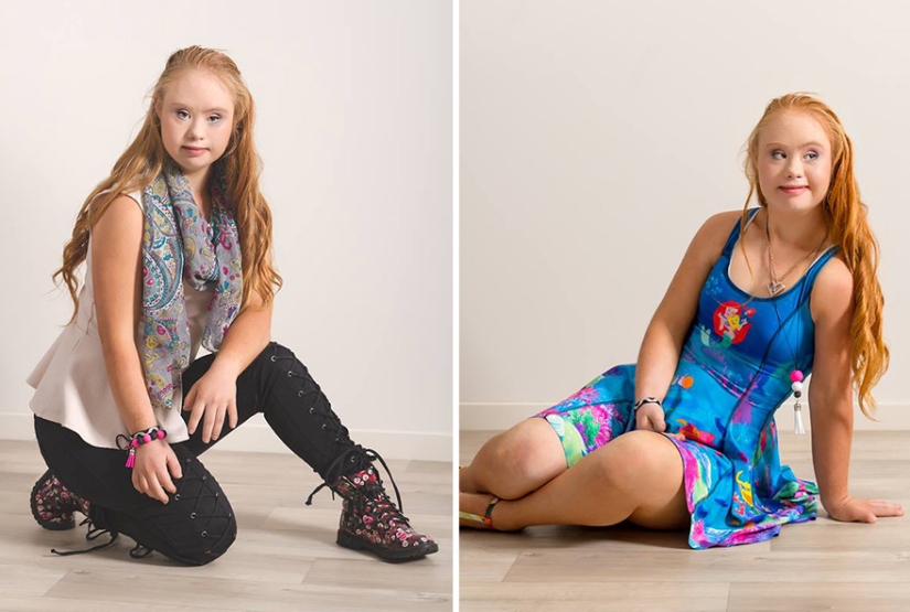 Model with Down syndrome: "We can be beautiful and sexy"