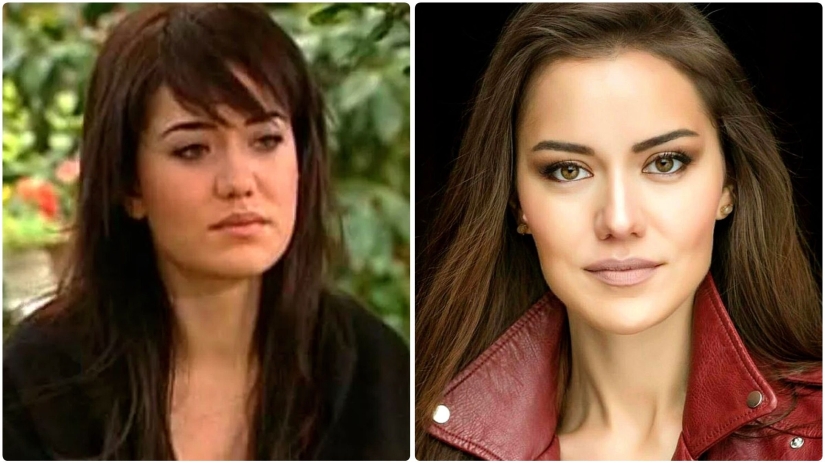 More than 14 operations were performed by the wife of Burak Ozchivit - what did she look like before aesthetics?