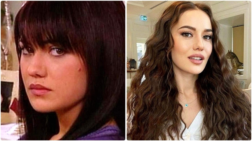 More than 14 operations were performed by the wife of Burak Ozchivit - what did she look like before aesthetics?