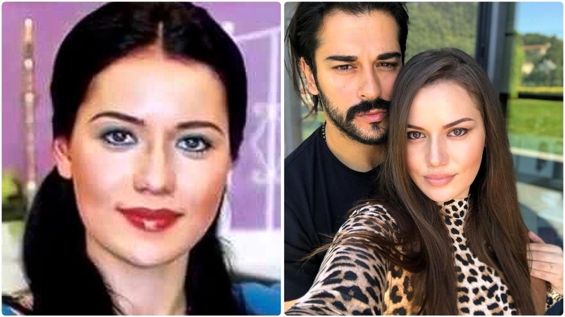 More than 14 operations were performed by the wife of Burak Ozchivit - what did she look like before aesthetics?