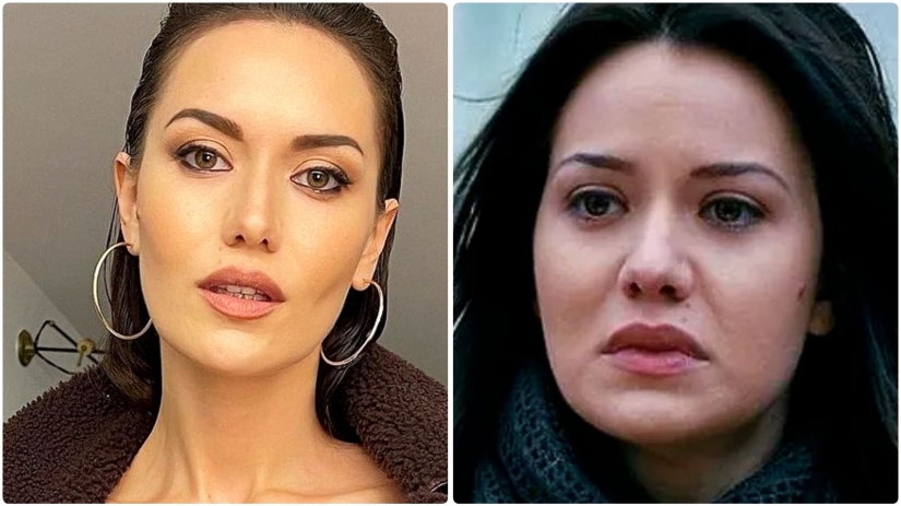 More than 14 operations were performed by the wife of Burak Ozchivit - what did she look like before aesthetics?