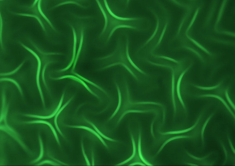 Nikon Small World Photomicrography Competition 2023: 16 Striking Images Taken By Scientists