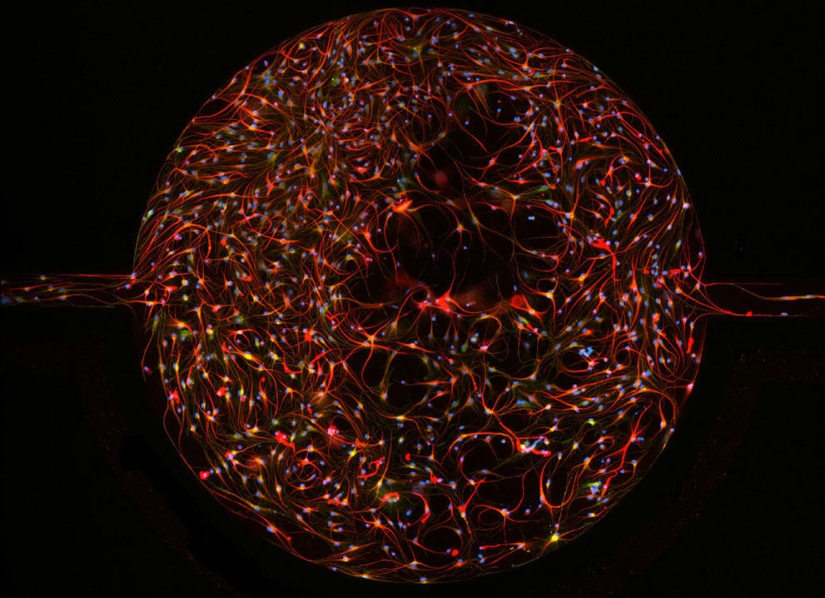 Nikon Small World Photomicrography Competition 2023: 16 Striking Images Taken By Scientists