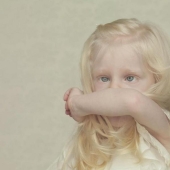 No como todos los demás: personas albinas