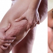 No gasto mucho dinero en batas costosas, pero las hago yo mismo. Receta favorita de exfoliación contra la celulitis