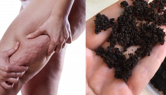 No gasto mucho dinero en batas costosas, pero las hago yo mismo. Receta favorita de exfoliación contra la celulitis