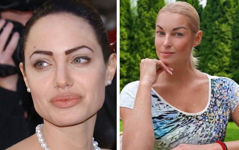 No vayas a la esteticista: 9 procedimientos de belleza más peligrosos e inútiles