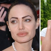 No vayas a la esteticista: 9 procedimientos de belleza más peligrosos e inútiles