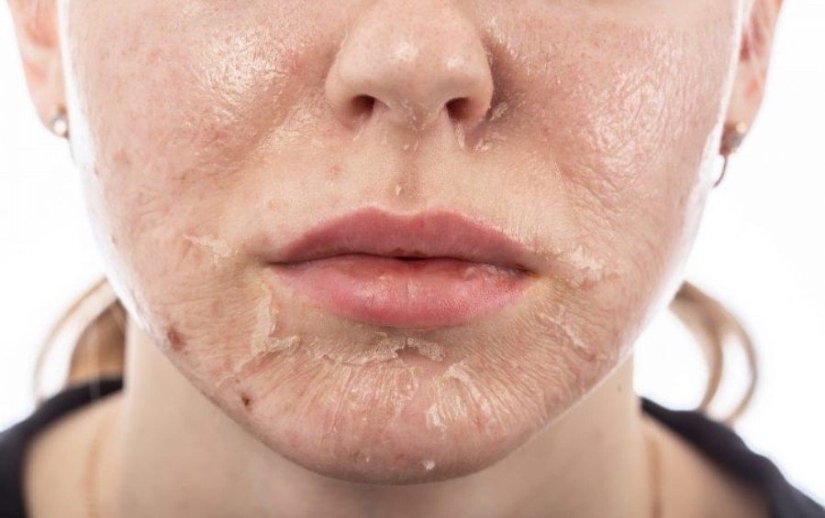 No vayas a la esteticista: 9 procedimientos de belleza más peligrosos e inútiles