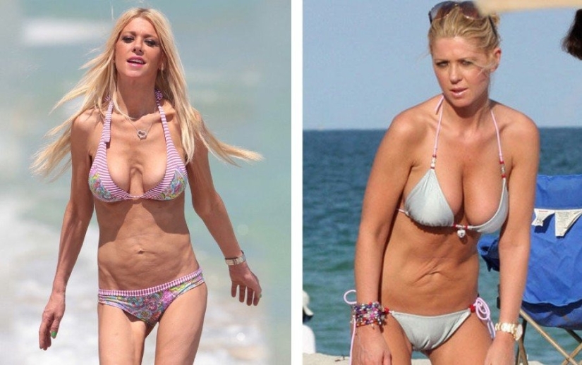 No vayas a la esteticista: 9 procedimientos de belleza más peligrosos e inútiles