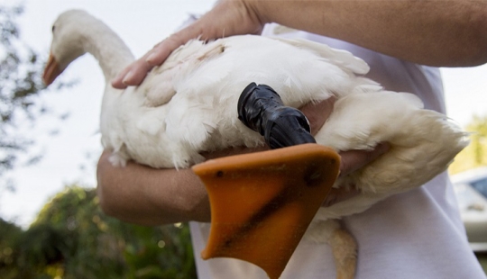 Nueva vida con un nuevo pie 3D