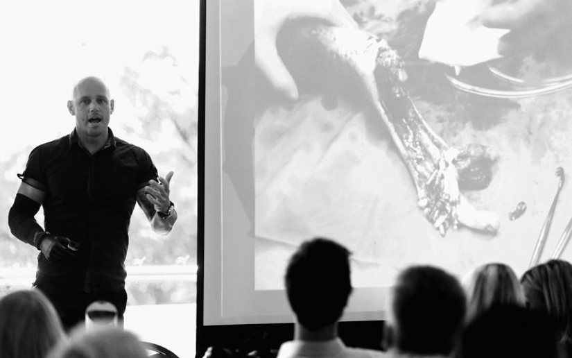 Nunca te rindas o la vida después del ataque de un tiburón