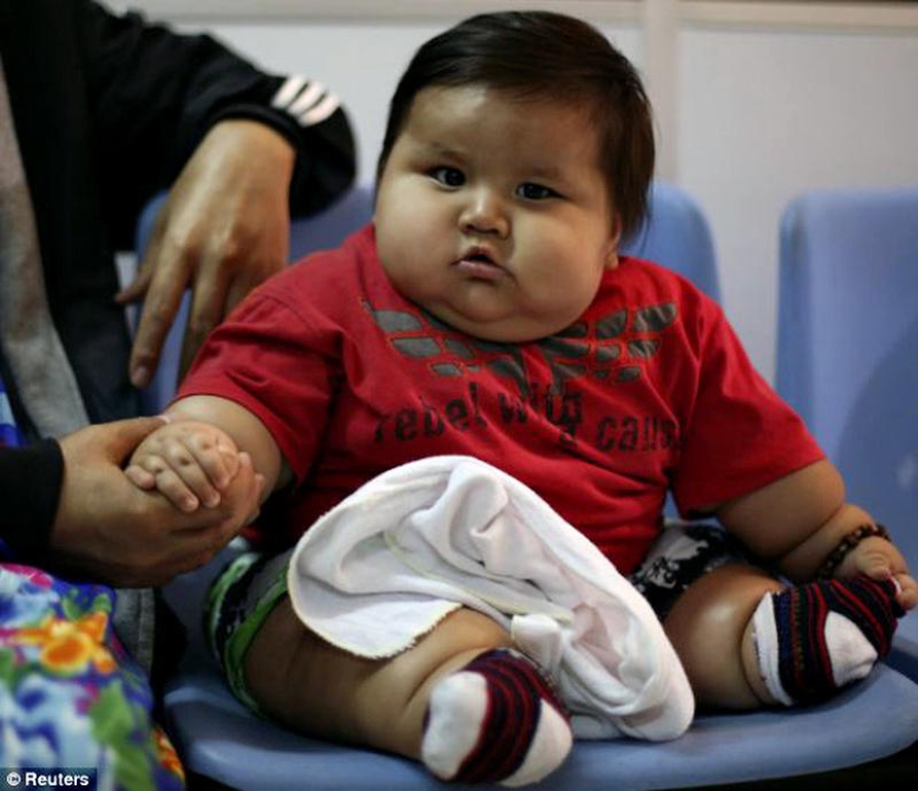 Obese 8-month-old baby seized from parents Obese 8-month-old baby seized from parents