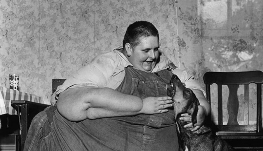 “Overweight by 590 kg”: lay on the couch all day and ate 10 kg of food a day to become the fattest in the world. What did he look like?