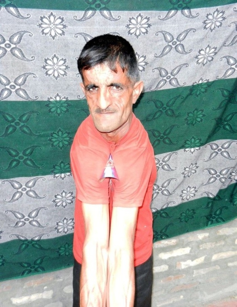 ¡Parece que encontramos un hombre de goma vivo! ¡Esta es una visita obligada! ¡Parece que encontramos un hombre de goma vivo! ¡Esta es una visita obligada!