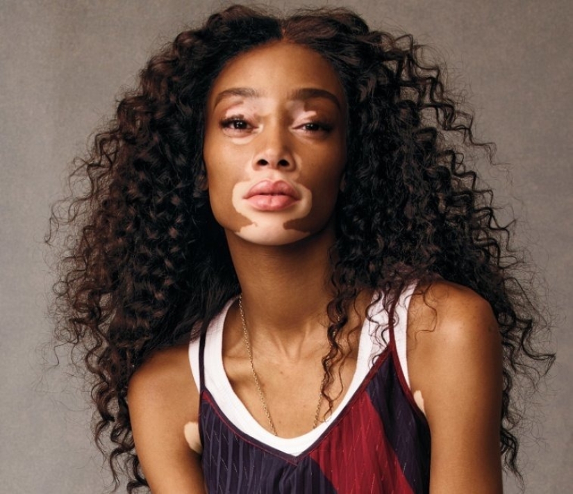 People with an unusual appearance. 8 photos