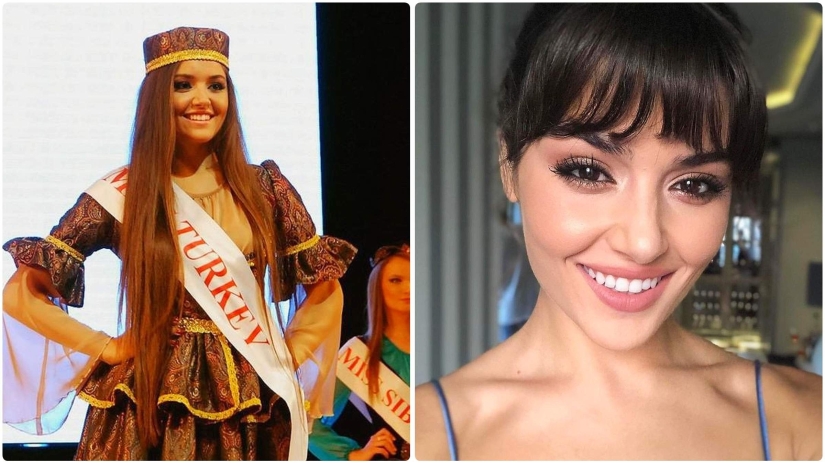 Photo before plastic surgery: the woman of the year did 10 operations and her relatives do not recognize her Photo before plastic surgery: the woman of the year did 10 operations and her relatives do not recognize her