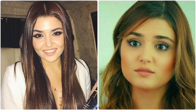 Photo before plastic surgery: the woman of the year did 10 operations and her relatives do not recognize her Photo before plastic surgery: the woman of the year did 10 operations and her relatives do not recognize her