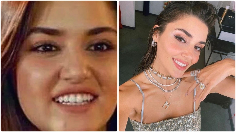 Photo before plastic surgery: the woman of the year did 10 operations and her relatives do not recognize her Photo before plastic surgery: the woman of the year did 10 operations and her relatives do not recognize her