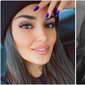 Photo before plastic surgery: the woman of the year did 10 operations and her relatives do not recognize her