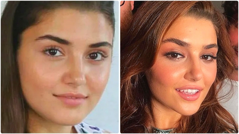 Photo before plastic surgery: the woman of the year did 10 operations and her relatives do not recognize her Photo before plastic surgery: the woman of the year did 10 operations and her relatives do not recognize her