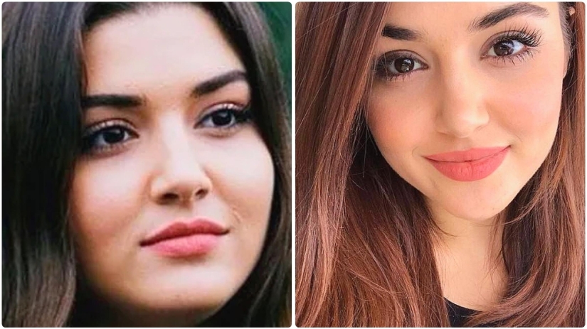 Photo before plastic surgery: the woman of the year did 10 operations and her relatives do not recognize her Photo before plastic surgery: the woman of the year did 10 operations and her relatives do not recognize her