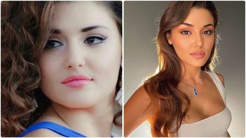 Photo before plastic surgery: the woman of the year did 10 operations and her relatives do not recognize her Photo before plastic surgery: the woman of the year did 10 operations and her relatives do not recognize her