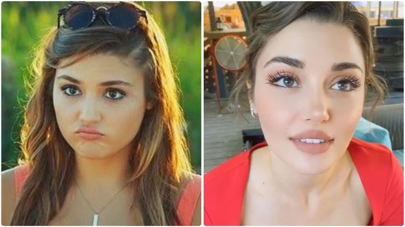 Photo before plastic surgery: the woman of the year did 10 operations and her relatives do not recognize her Photo before plastic surgery: the woman of the year did 10 operations and her relatives do not recognize her