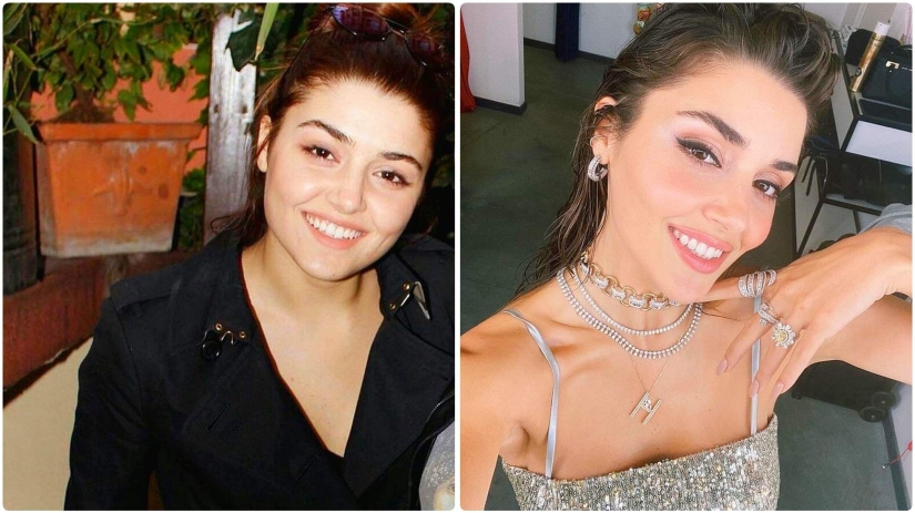 Photo before plastic surgery: the woman of the year did 10 operations and her relatives do not recognize her Photo before plastic surgery: the woman of the year did 10 operations and her relatives do not recognize her