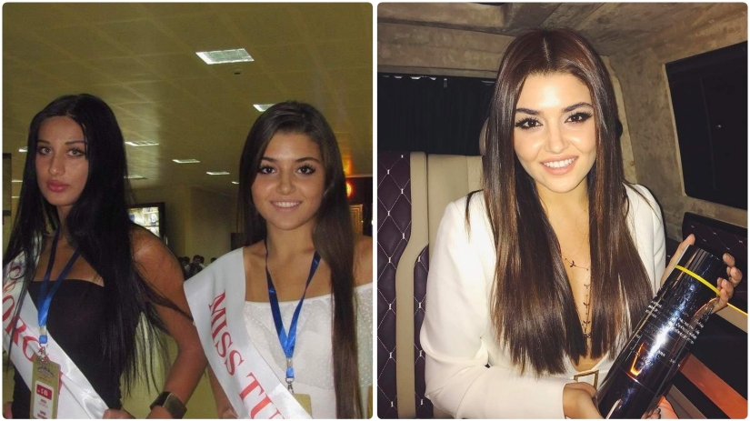 Photo before plastic surgery: the woman of the year did 10 operations and her relatives do not recognize her Photo before plastic surgery: the woman of the year did 10 operations and her relatives do not recognize her