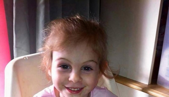 Pit bull mutilated 3-year-old girl kicked out of diner because of her appearance Pit bull mutilated 3-year-old girl kicked out of diner because of her appearance