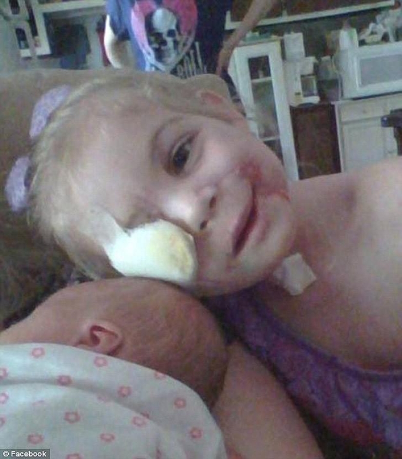 Pitbull mutiló a niña de 3 años y la echaron de restaurante por su apariencia Pitbull mutiló a niña de 3 años y la echaron de restaurante por su apariencia