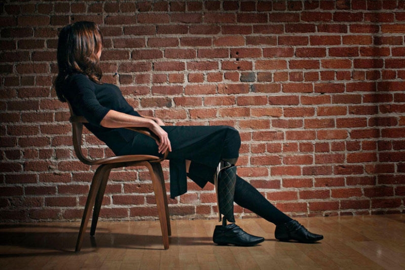 Prostheses can also be elegant and stylish!