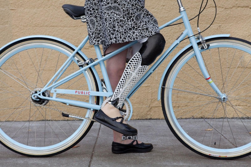 Prostheses can also be elegant and stylish!