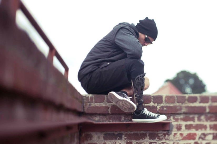 Prostheses can also be elegant and stylish!