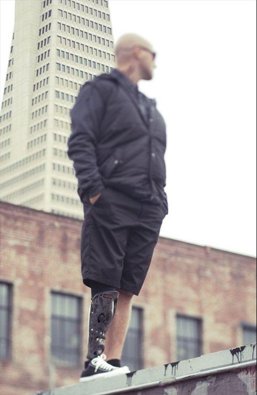 Prostheses can also be elegant and stylish!