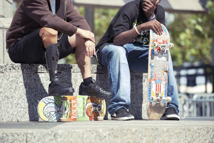 Prostheses can also be elegant and stylish!