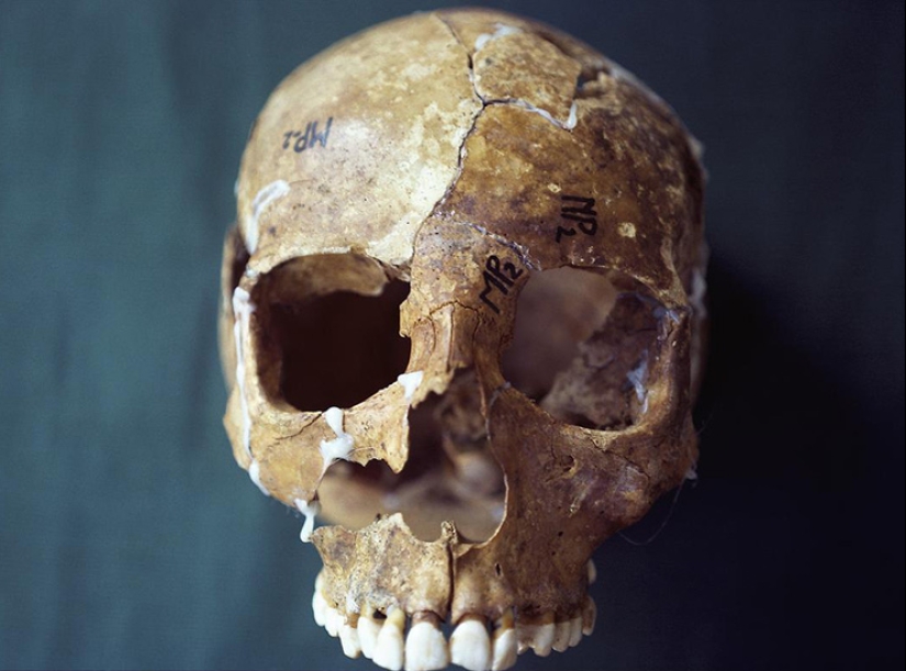 "¿Quién puso a Bella en el olmo?": un hallazgo espeluznante en el bosque sorprendió a un pequeño pueblo