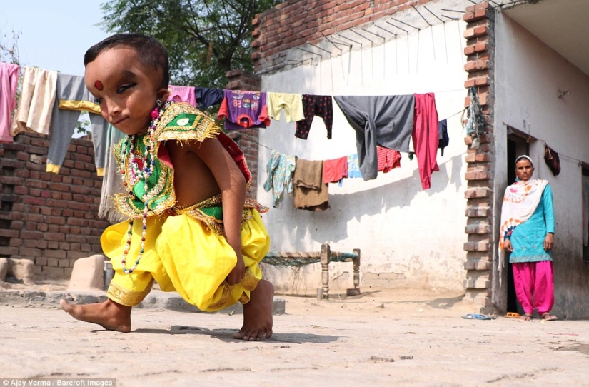 Residents of an Indian village worship a boy with a deformed head as the god Ganesha