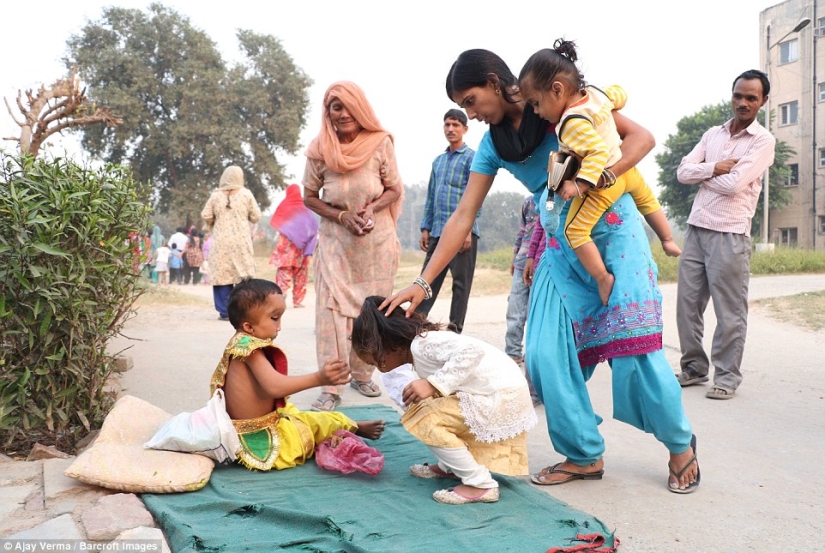 Residents of an Indian village worship a boy with a deformed head as the god Ganesha