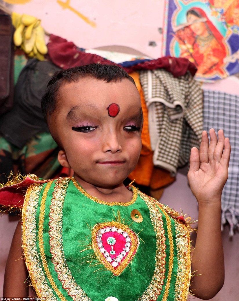 Residents of an Indian village worship a boy with a deformed head as the god Ganesha