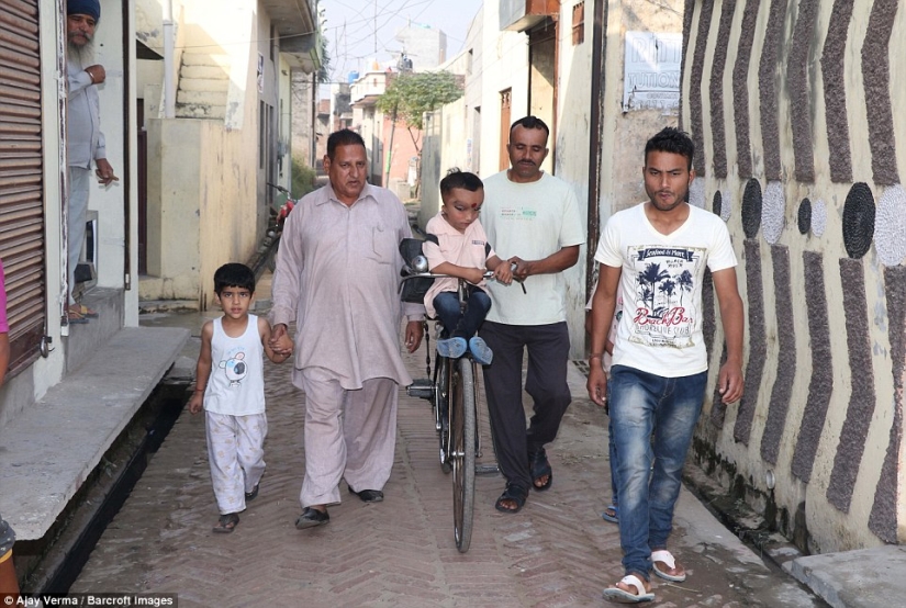 Residents of an Indian village worship a boy with a deformed head as the god Ganesha