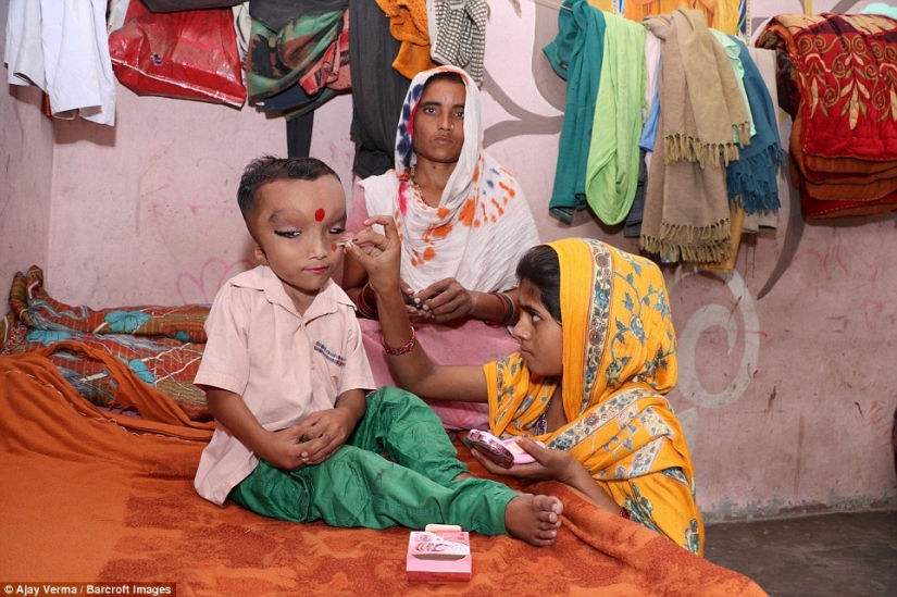 Residents of an Indian village worship a boy with a deformed head as the god Ganesha