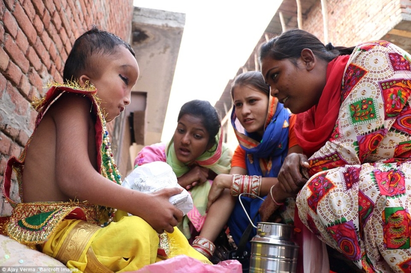 Residents of an Indian village worship a boy with a deformed head as the god Ganesha